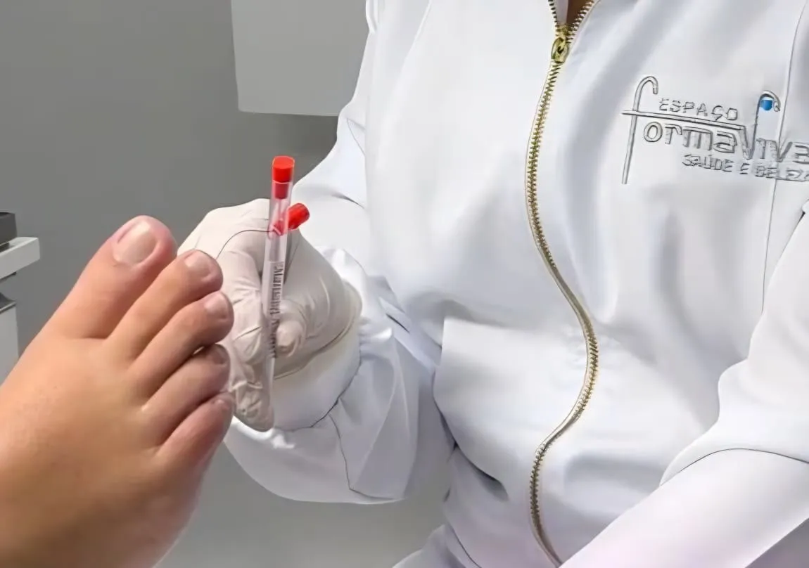 Aplicação do monofilamento nos dedos do pé, com a profissional de jaleco do Espaço Forma Viva